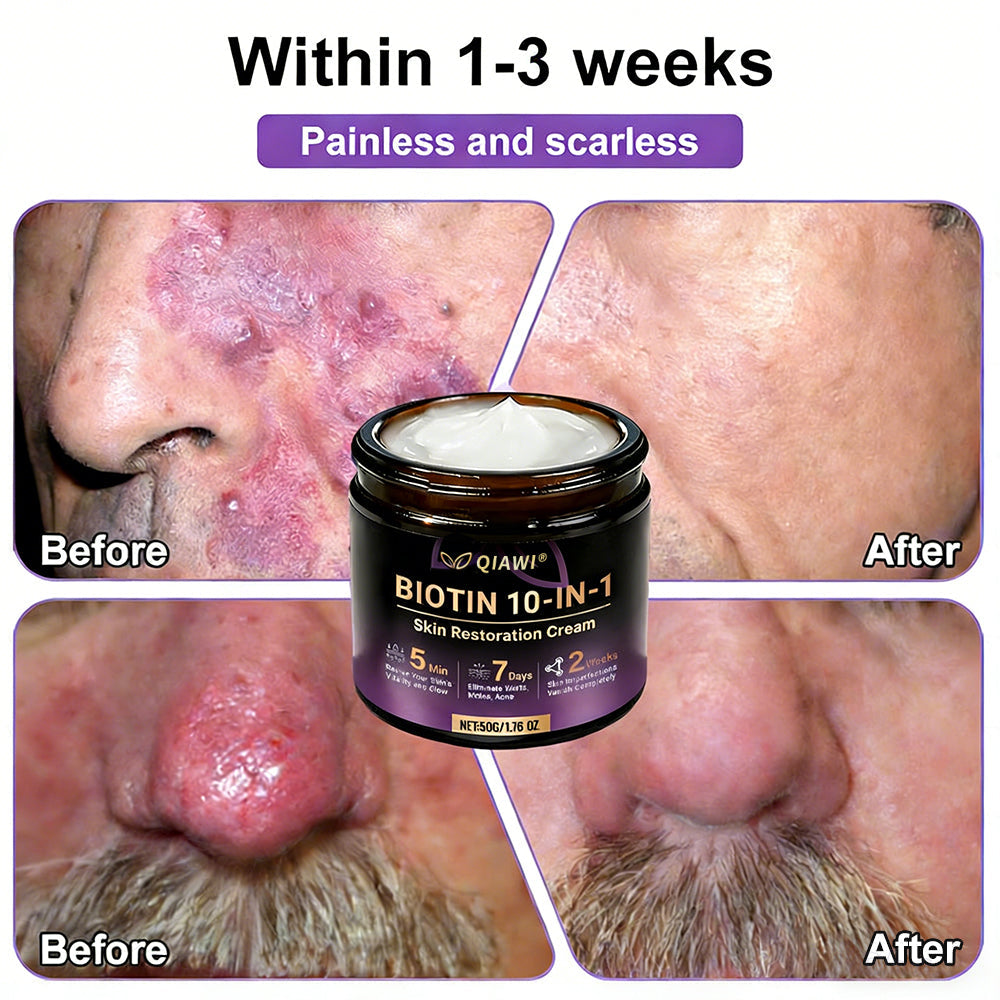 Made and Shipped from USA 🍁 QIAWI® Biotin 10-in-1 Skin Restoration Cream – Last Day Promotion: 75% OFF