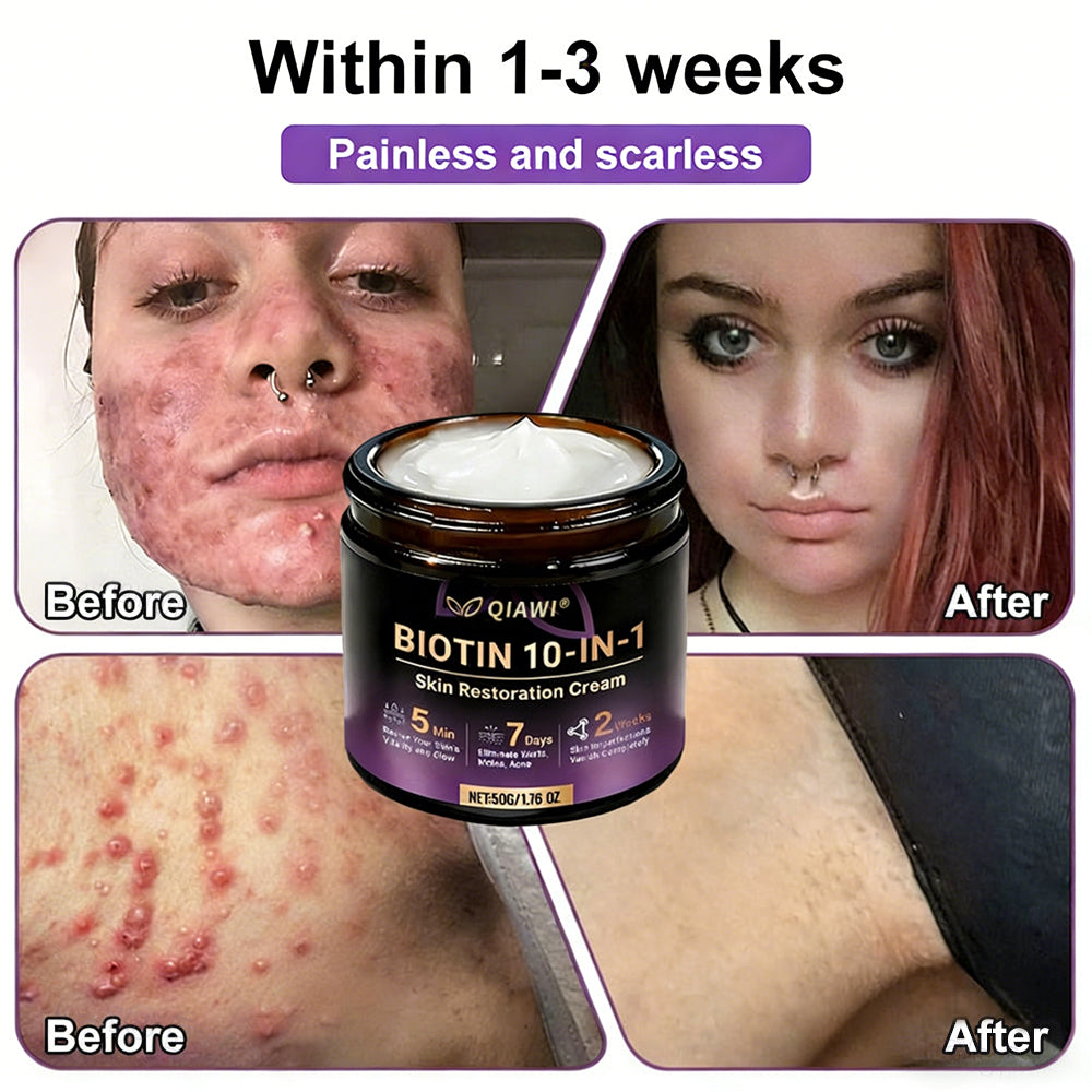 Made and Shipped from USA 🍁 QIAWI® Biotin 10-in-1 Skin Restoration Cream – Last Day Promotion: 75% OFF