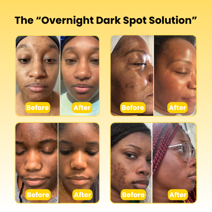 Medicube Turmeric Overnight Wrapping Peel Off Mask - Nourishes dull, uneven skin with hydrolyzed collagen for glowing skin and improved elasticity. Korean skincare