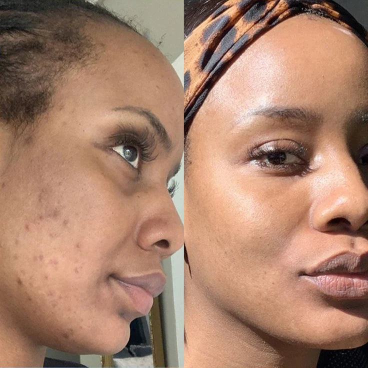 Medicube Turmeric Overnight Wrapping Peel Off Mask - Nourishes dull, uneven skin with hydrolyzed collagen for glowing skin and improved elasticity. Korean skincare