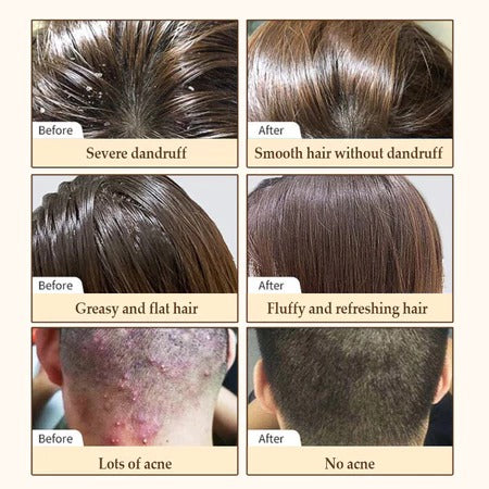 Hair Growth Shampoo with Biotin & DHT Blocker – 250ml