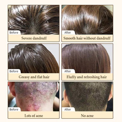 Hair Growth Shampoo with Biotin & DHT Blocker – 250ml