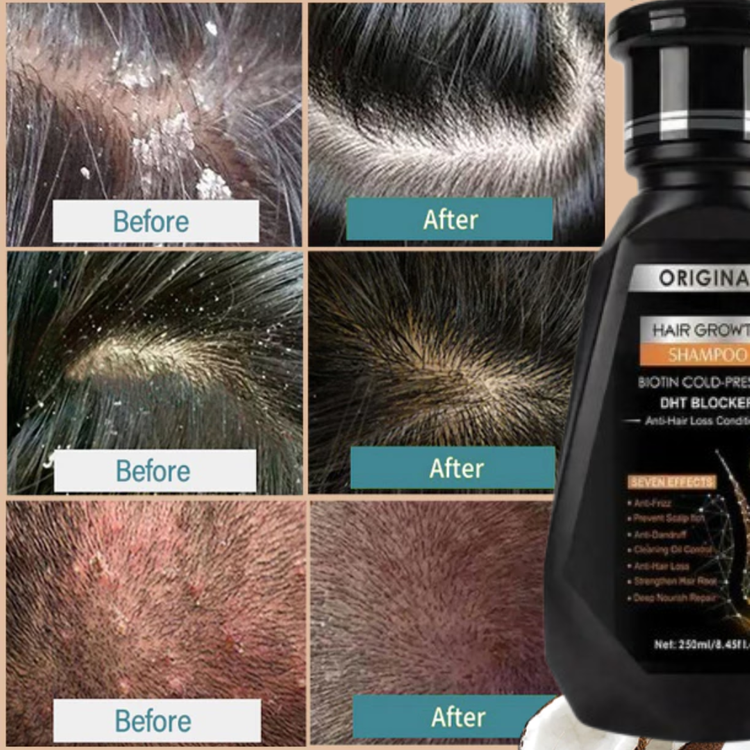 Hair Growth Shampoo with Biotin & DHT Blocker – 250ml