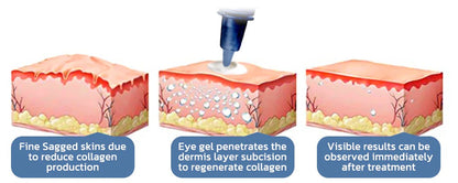 OPENEYES Awaken Peptide Lifting Eye Gel