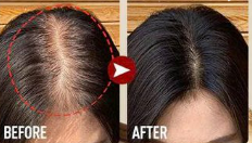 Hair Growth Shampoo with Biotin & DHT Blocker – 250ml